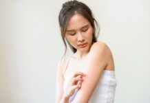 Wysypka alergiczna na ciele, jak z nią walczyć, co zrobić?