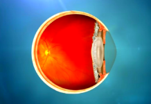 Zaćma - objawy przyczyny leczenie - kolorowy przekrój gałki ocznej ze zdrową soczewką. Przejrzystą i bez zmętnień.