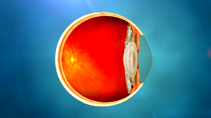 Zaćma - objawy przyczyny leczenie - kolorowy przekrój gałki ocznej ze zdrową soczewką. Przejrzystą i bez zmętnień.