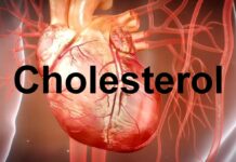 Cholesterol zły czy dobry - komputerowa grafika pokazująca serce wraz z naczyniami krwionośnymi. W centrum czarny napis cholesterol.