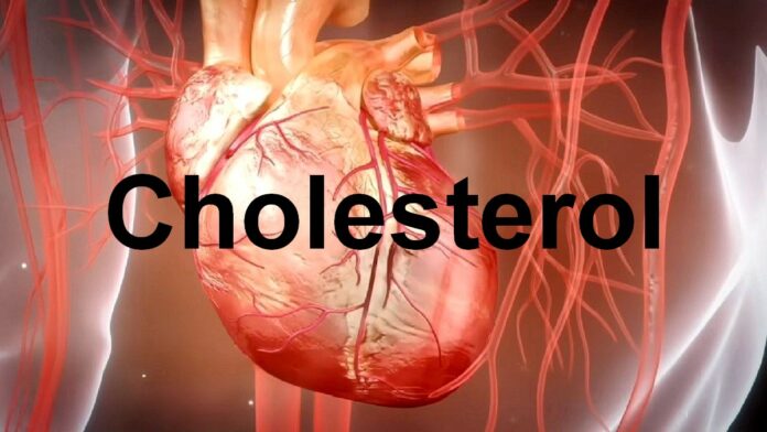 Cholesterol zły czy dobry - komputerowa grafika pokazująca serce wraz z naczyniami krwionośnymi. W centrum czarny napis cholesterol.