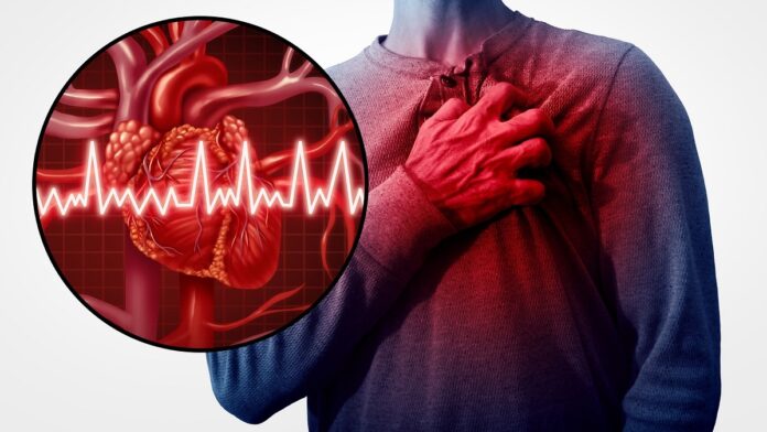 Zawał serca - na białym tle mężczyzna trzyma się spazmatycznie za okolice serca, obok ilustracja serca z wykresem EKG