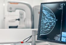rak piersi - zbliżenie naczarno-biały ekran z wyświetlonym mammogramem piersi. W oddali niewyraźne wnętrze gabinetu lekarskiego.