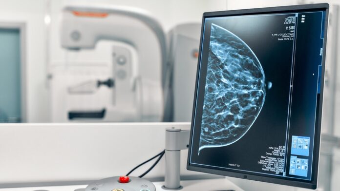 rak piersi - zbliżenie naczarno-biały ekran z wyświetlonym mammogramem piersi. W oddali niewyraźne wnętrze gabinetu lekarskiego.