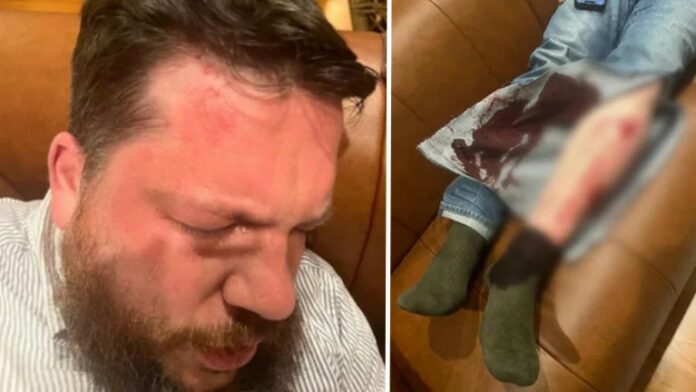 Polacy zaatakowali współpracownika Nawalnego. Na zdjęciu Leonid Wołkow